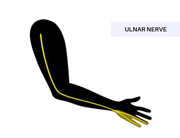 Vetor poster anatômico do nervo ulnar