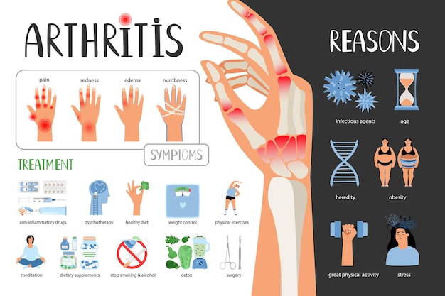 Vetor poster médico do vetor da artrite reumatoide sintomas tratamento razões da doença infográfico médico com ícones e outros elementos