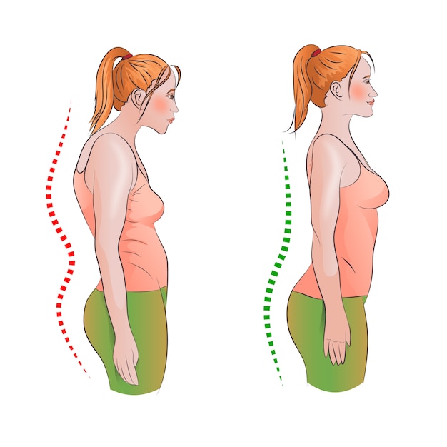 Vetor postura de costas direita e errada
