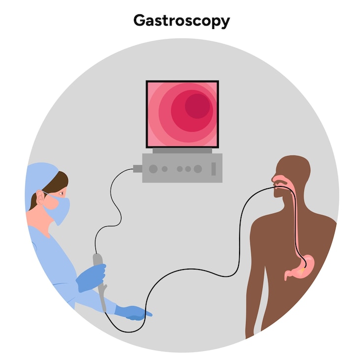 Vetor procedimento de gastroscopia com o paciente e o médico
