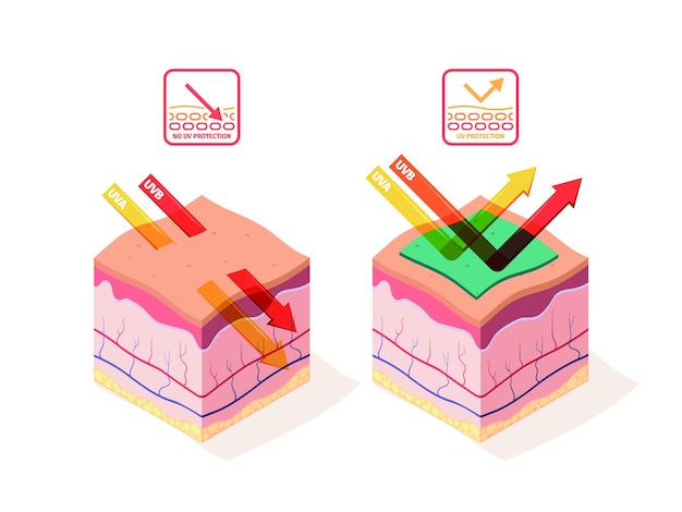 Proteção uv do sol estrutura da pele humana danos camadas do corpo casca 3d ilustrações técnicas isométricas modelos de vetores berrantes