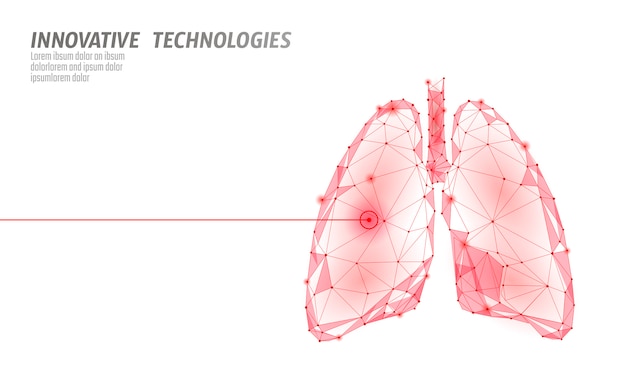 Pulmões humanos operação de cirurgia a laser baixa poli. medicina doença tratamento medicamentoso área dolorosa. triângulos vermelhos poligonais 3d render forma. ilustração de modelo de câncer de tuberculose de farmácia