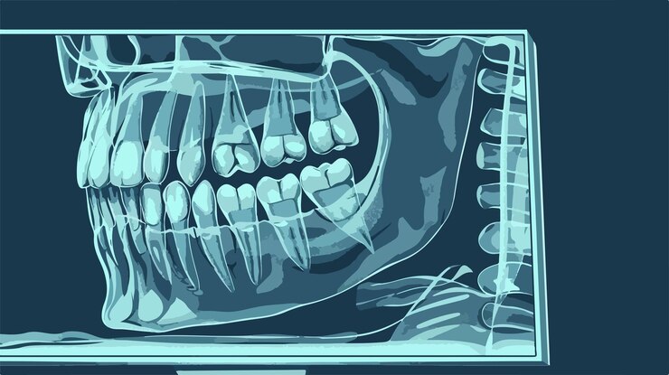 Vetor radiografia intraoral detalhada de dentes e gengivas humanos para profissionais odontológicos