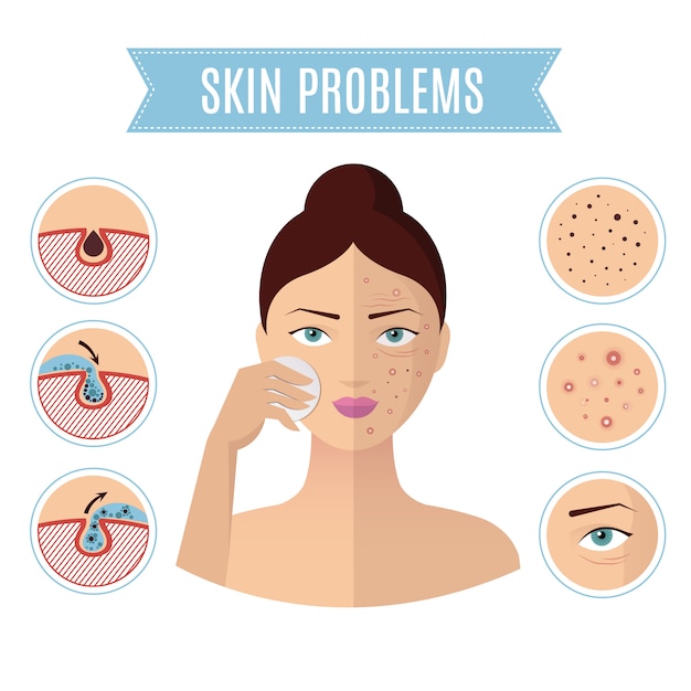 Vetor resolução de problemas de pele, tratamento de acne e limpeza de pore para ícones de rosto de mulher perfeita
