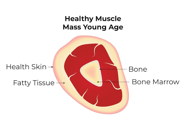 Vetor saúde da massa e força muscular ilustração do vetor da sarcopenia pele solta tecido adiposo ósseo