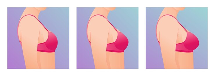 Vetor seios femininos em sutiã antes e depois do aumento conceito de cirurgia plástica