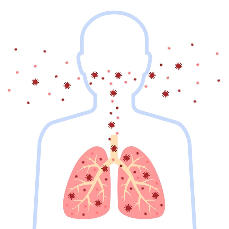 Vetor silhueta do homem infectado do sistema respiratório projeto do vírus corona com pulmões e vírus da doença