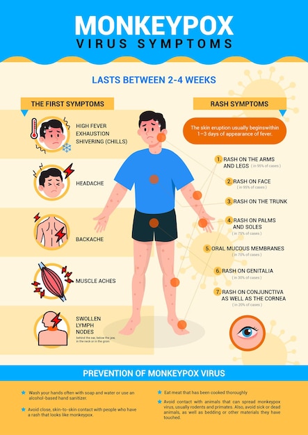 Sintomas do vírus Monkeypox e design de vetor de pôster infográfico de prevenção