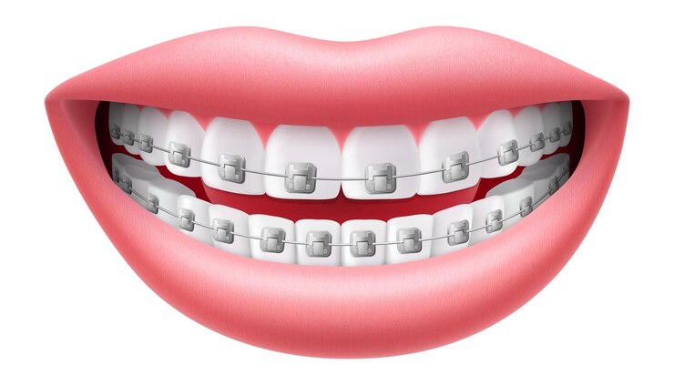 Vetor sorrindo com dentes brancos e aparelhos isolados em fundo branco