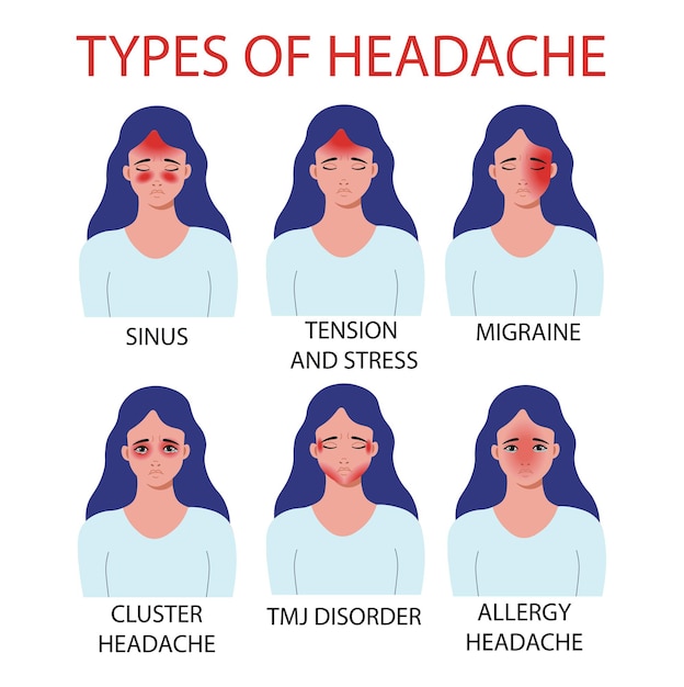 Tipos de dor de cabeça. alergia, atm, dor na articulação temporomandibular, cefaléia em salvas, migraine, seios da face, tensão e estresse. ilustração vetorial