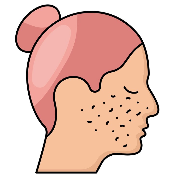 Vetor tratamento de acne reaparecimento da pele ou microdermabrasão design vetorial de beleza e cuidados pessoais cosméticos