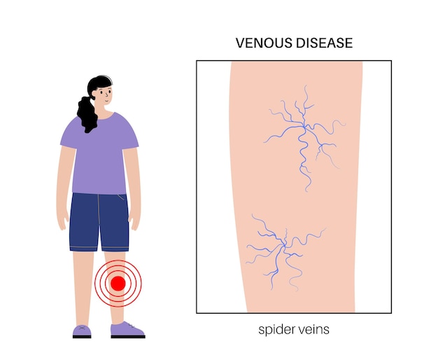 Vetor tratamento de vasinhos