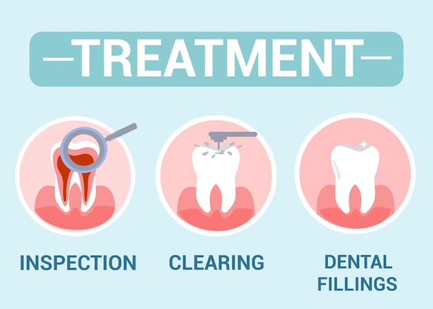 Vetor tratamento dentário, conceito de serviço de dentista