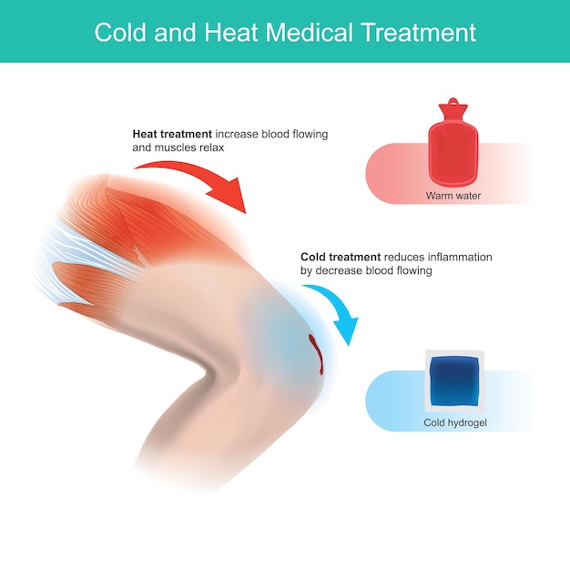Tratamento médico para frio e calor.
