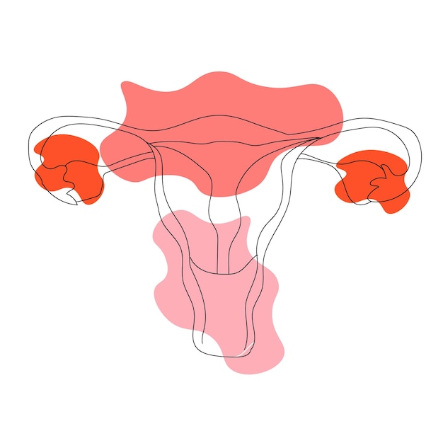 Um doodle de arte de linha de desenho contínuo útero das mulheres.