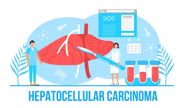 Vetor vetor de conceito de carcinoma hepatocelular hepatite abcd cirrose dia mundial da hepatite pequenos médicos tratam o fígado