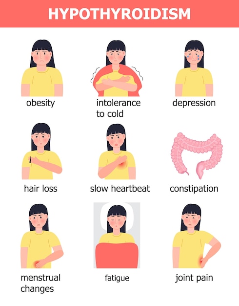 Vetor de infográfico médico de hipotireoidismo ilustração de endocrinologia