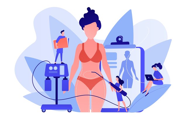 Chirurgo plastico con un tubo di aspirazione che fa la liposuzione di parti del corpo marcate della donna. Liposuzione, procedura lipo, concetto di chirurgia di rimozione del grasso. Pinkish coral bluevector illustrazione isolata