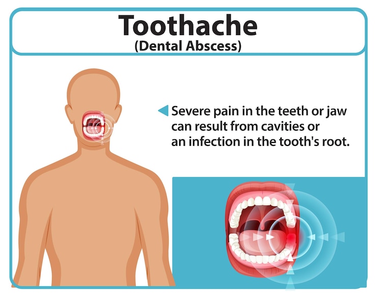 Vettore gratuito comprendere il mal di dente e l'assesso dentale