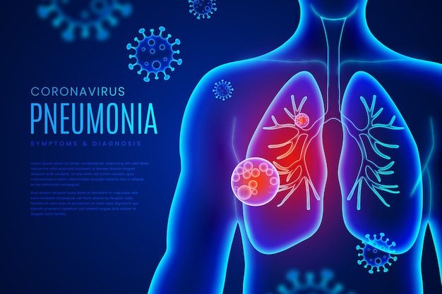 Concetto di polmonite da coronavirus