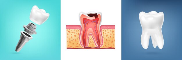 Design realistico con illustrazione di anatomia del dente umano