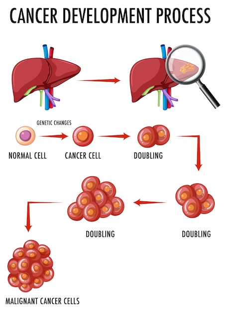 Diagramma che mostra il processo di sviluppo del cancro