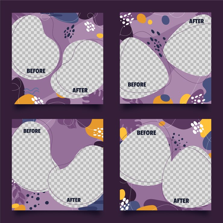 Vettore gratuito disegnato a mano prima e dopo la raccolta di post ig