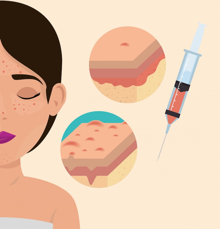 Vettore gratuito donna con trattamento di botox