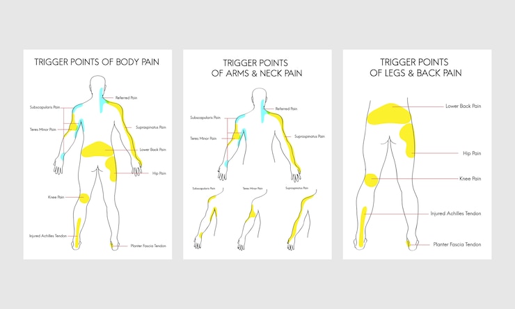 Vettore gratuito illustrazione dei punti di dolore del corpo