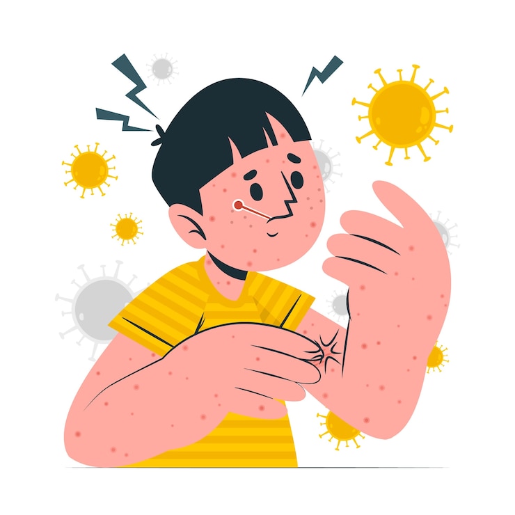 Vettore gratuito illustrazione del concetto di morbillo