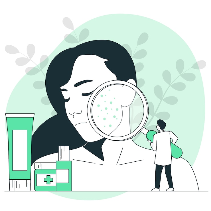 Vettore gratuito illustrazione del concetto di trattamento dell'acne