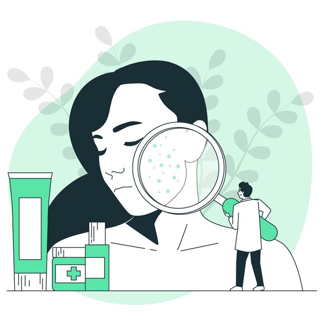 Illustrazione del concetto di trattamento dell'acne