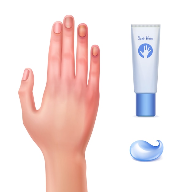 illustrazione della mano ferita e gel tubo per contusioni con goccia di crema