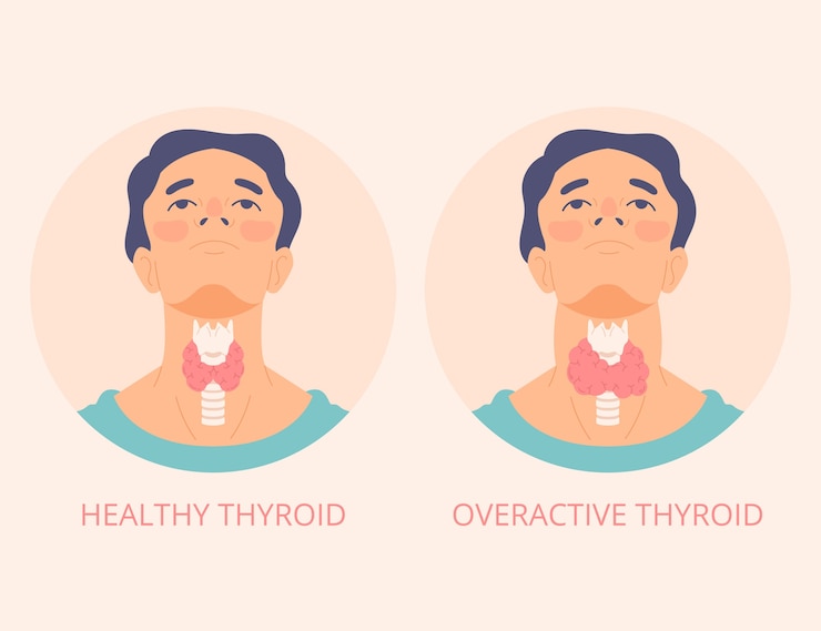 Vettore gratuito illustrazione della tiroide di design piatto disegnato a mano