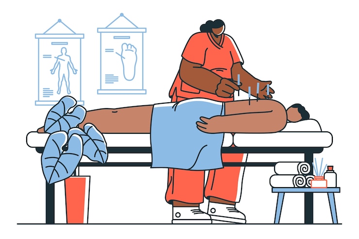 Vettore gratuito illustrazione di agopuntura
