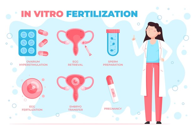 Infografica ivf design piatto disegnata a mano