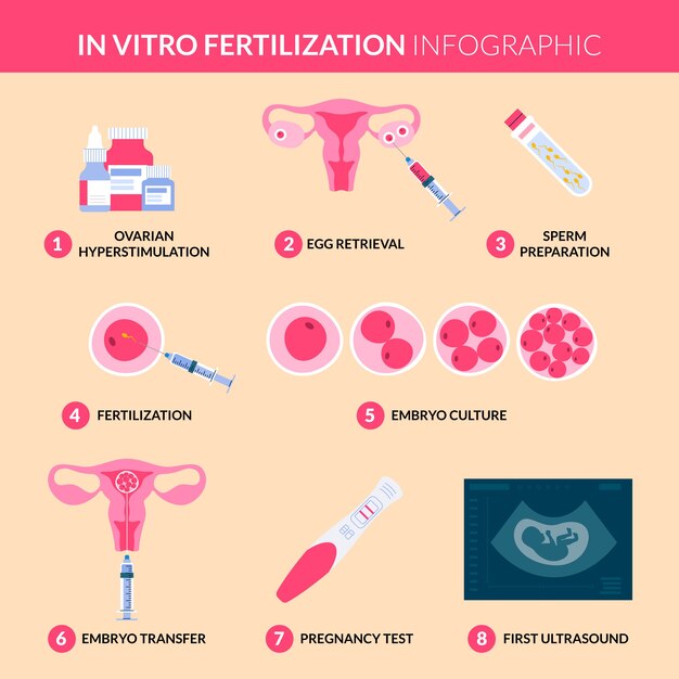 Infografica ivf design piatto disegnata a mano