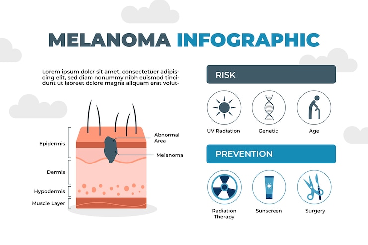 Vettore gratuito infografica sul melanoma dal design piatto disegnato a mano