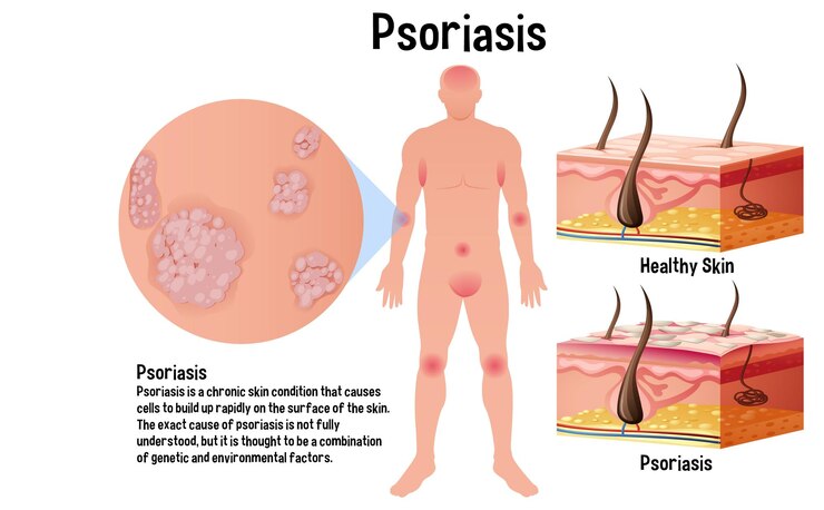 Vettore gratuito infografica sulle condizioni della pelle umana con spiegazione