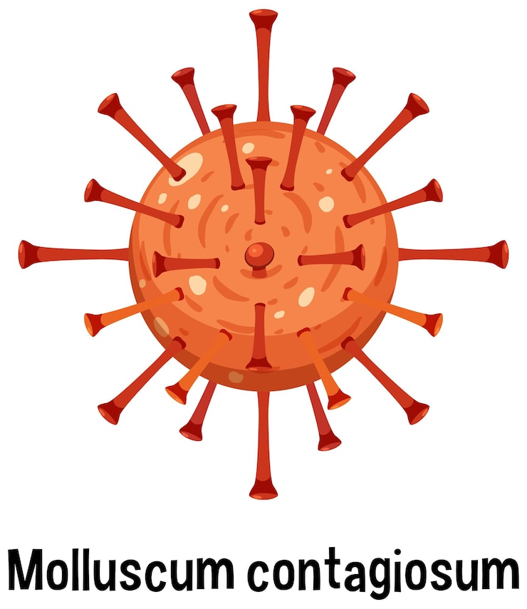 Vettore gratuito mollusco contagioso con testo