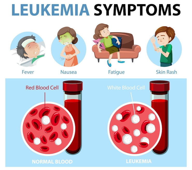 Vettore gratuito sintomi di leucemia in stile cartone animato infografica