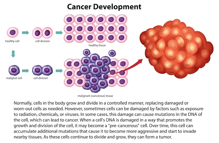 Vettore gratuito vettore di sviluppo del cancro con informazioni