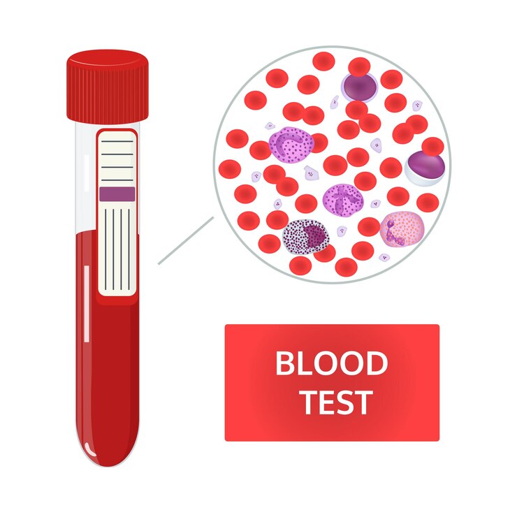 Vettore analisi del sangue in provette e composizione del sangue al microscopio globuli rossi e bianchi