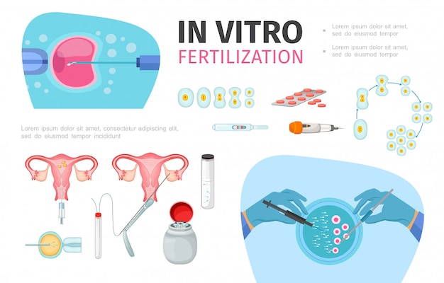 Composizione di fecondazione in vitro piatta con procedura di preparazione dello sperma sviluppo dell'embrione e trasferimento di strumenti medici per il processo di inseminazione