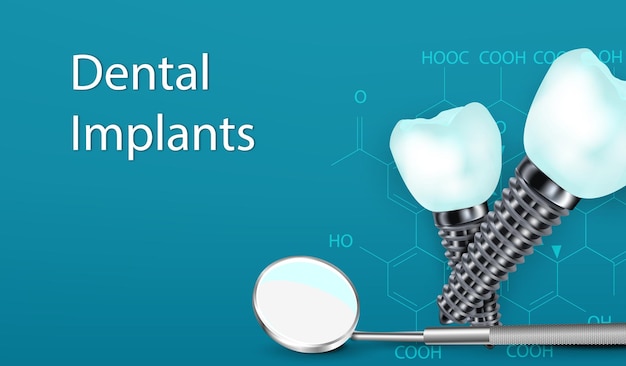 Concetto di chirurgia degli impianti dentali 3D con lo strumento