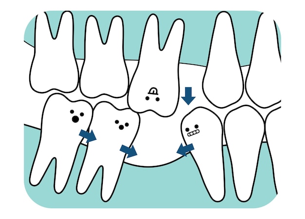 conseguenza il problema del dente mancante illustrazione piatta