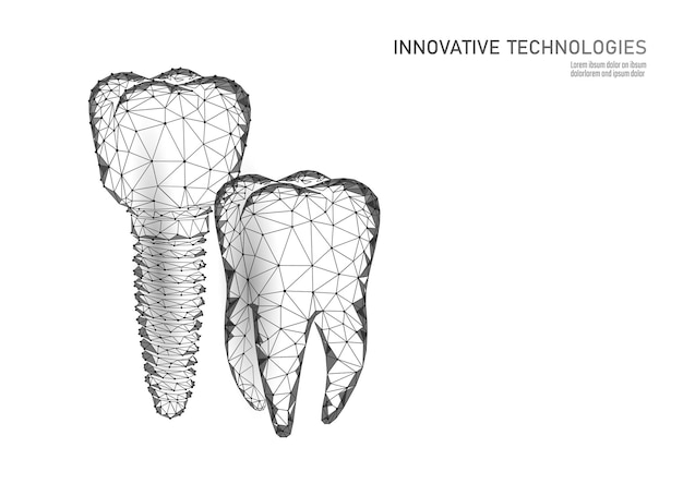 Dente molare impianto dentale d low poly modello geometrico odontoiatria innovazione tecnologia futura titan m