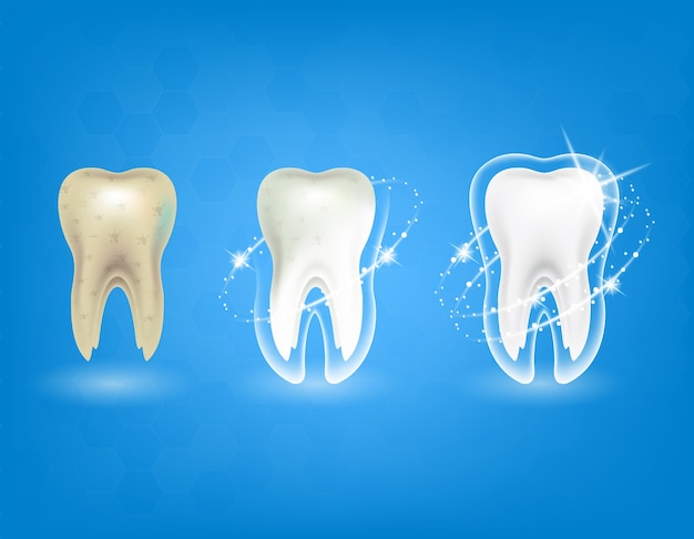 Dente