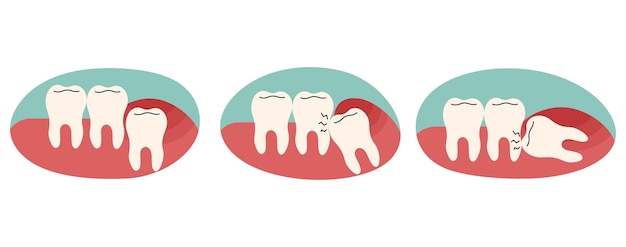 Denti del giudizio 2