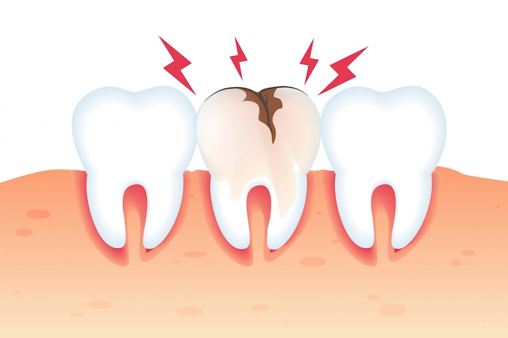 Dolore nell&#39;illustrazione dentata del dente rotto 3d.